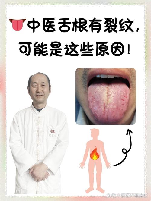 澳门研究生资料公开,和舌根和牙龈被缝一起与舌根和牙龈被缝一起怎么办
