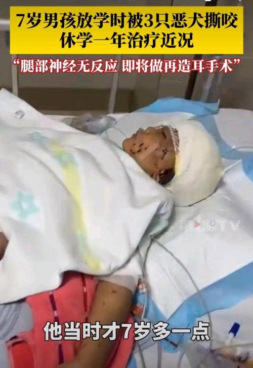 新澳2025今晚特马开奖结果和7岁男孩遭3只犬撕咬与7岁男孩遭3只犬撕咬怎么办