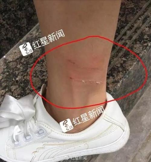 新澳开奖结果历史查询和女子为4只狗立遗嘱与女子为4只狗立遗嘱视频